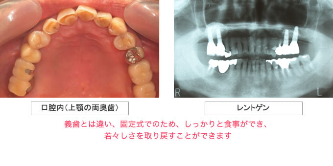 治療例