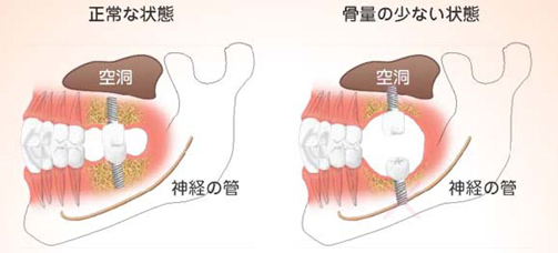 こんな場合には！！